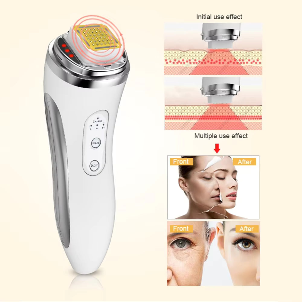 Advanced RF Beauty Wand - Facial Rejuvenation & Skin Tightening Device